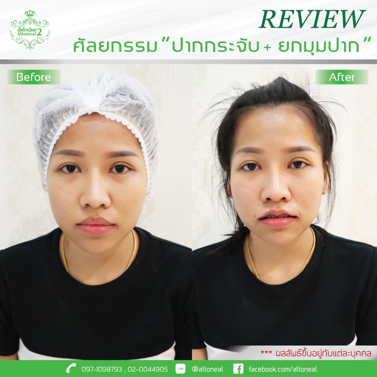 Review_2_20ปาก1001
